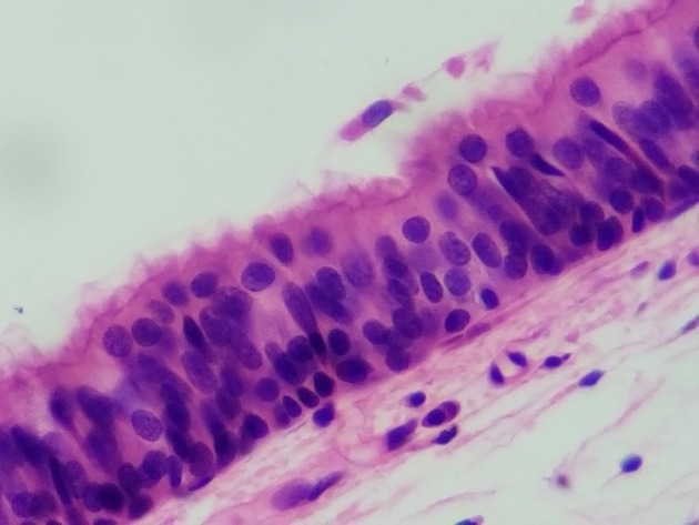 Pseudostratified Epithelium Slides - Pseudostratified Epithelium 23 400X